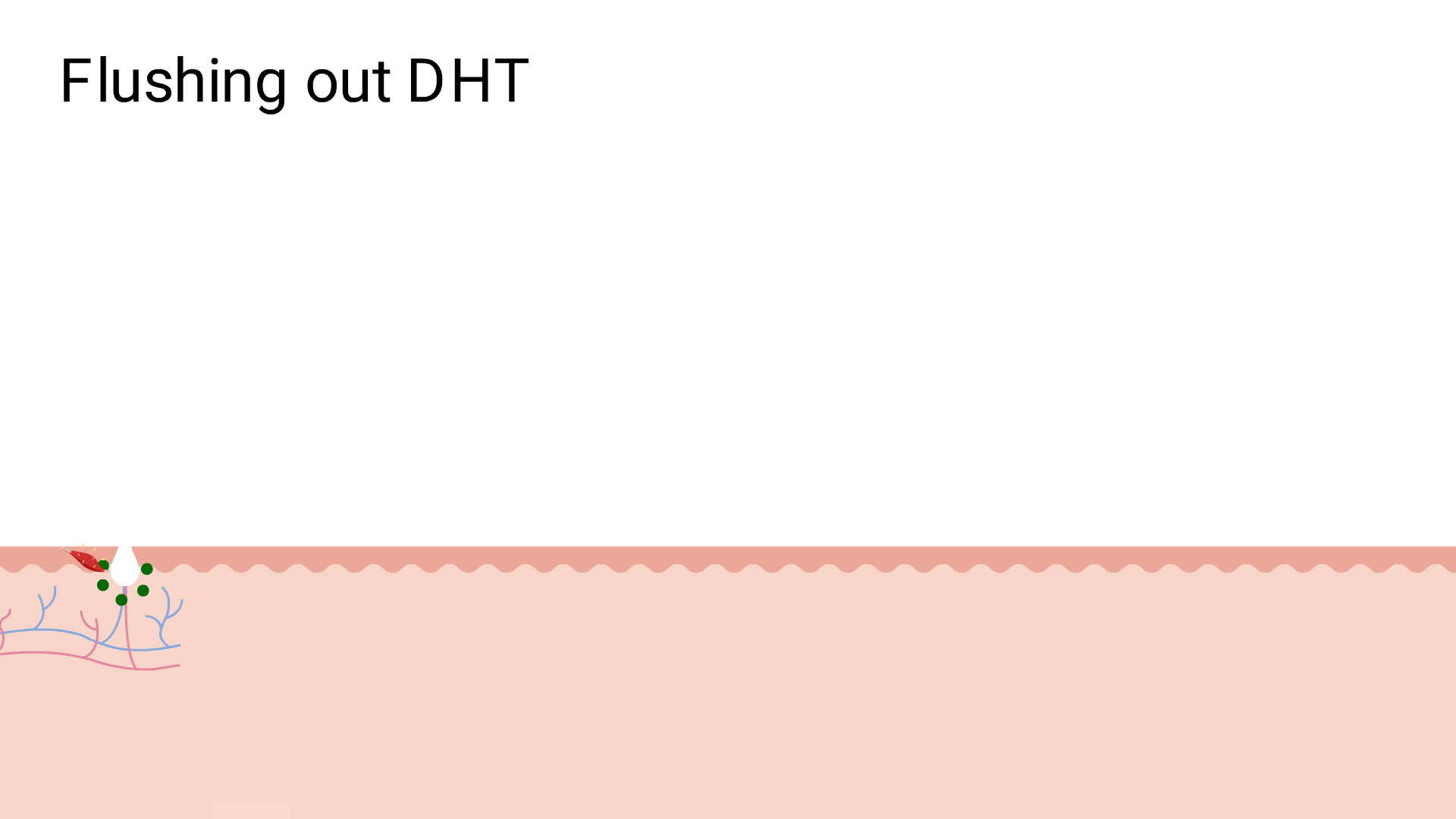 DHT the culprit to male pattern baldness being flushed out.