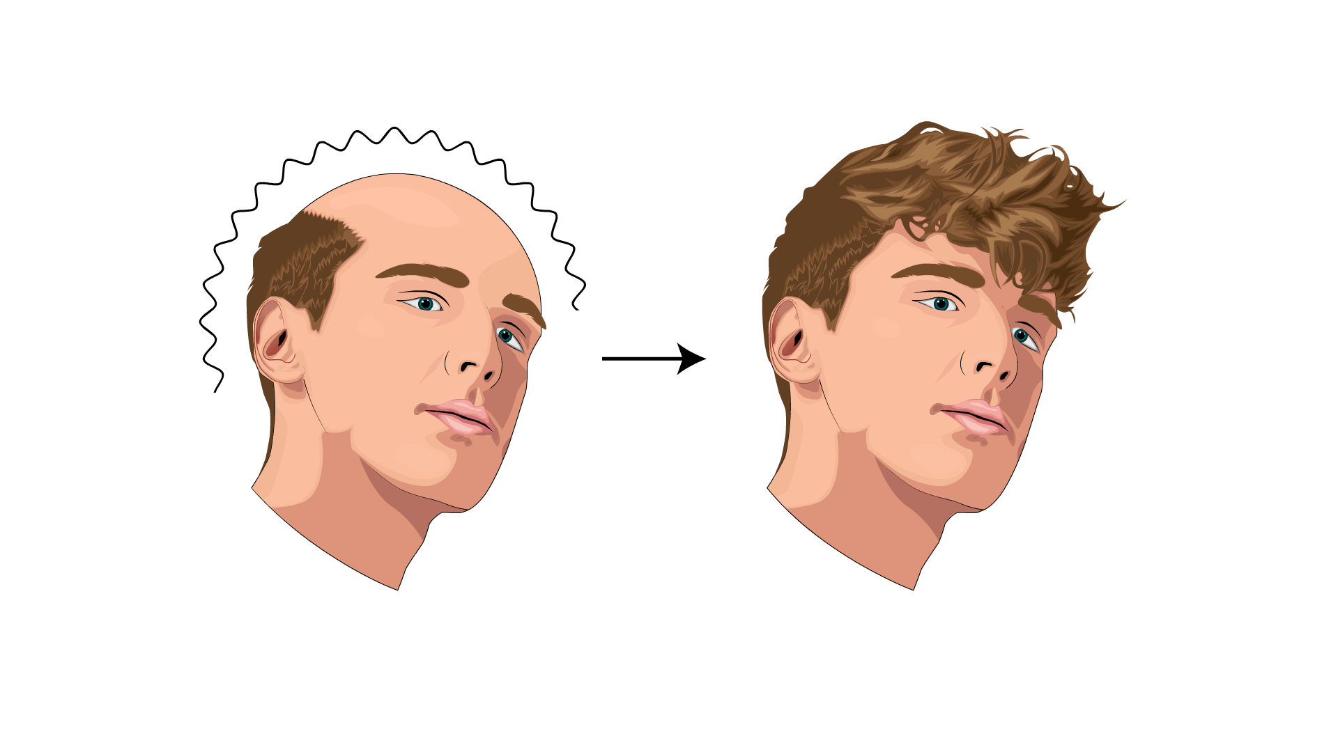 hair regrowth